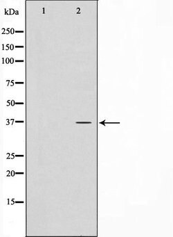 Invitrogen CTU1 Polyclonal Antibody 100 &mu;L | Buy Online | Invitrogen&trade; | Fisher Scientific