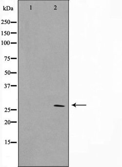 Invitrogen SIX6 Polyclonal Antibody 100 &mu;L; Unconjugated:Antibodies,