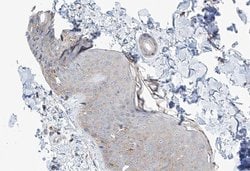 Invitrogen MAST4 Polyclonal Antibody 100 &mu;L | Buy Online | Invitrogen&trade; | Fisher Scientific