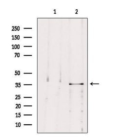 Invitrogen MAST4 Polyclonal Antibody 100 &mu;L | Buy Online | Invitrogen&trade; | Fisher Scientific