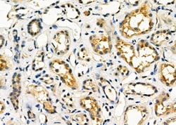 Invitrogen STARD13 Polyclonal Antibody 100 &mu;L; Unconjugated:Antibodies,