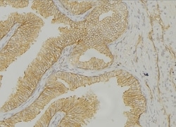 Invitrogen Cytokeratin 14/16 Polyclonal Antibody 100 &mu;L | Buy Online | Invitrogen&trade; | Fisher Scientific