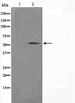 Invitrogen Cytokeratin 14/16 Polyclonal Antibody 100 &mu;L | Buy Online | Invitrogen&trade; | Fisher Scientific