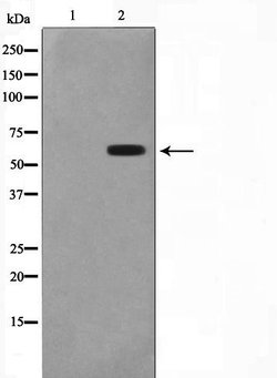 Invitrogen CYP2C19 Polyclonal Antibody 100 &mu;L; Unconjugated:Antibodies,