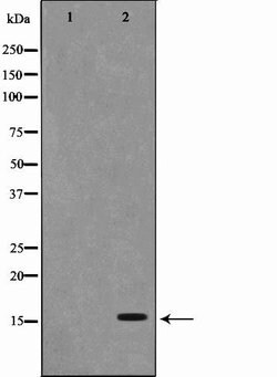 Invitrogen PFDN1 Polyclonal Antibody 100 &mu;L | Buy Online | Invitrogen&trade; | Fisher Scientific