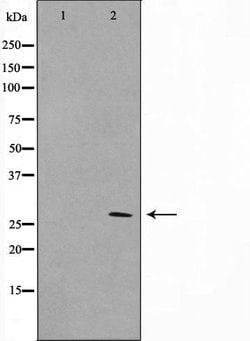 Invitrogen KDELR3 Polyclonal Antibody 100 &mu;L; Unconjugated:Antibodies,