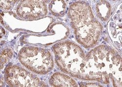 MRRF Polyclonal Antibody, Invitrogen™