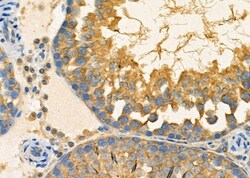 MRRF Polyclonal Antibody, Invitrogen&trade;