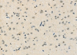 CtBP1 Polyclonal Antibody:Antibodies, Polyclonal