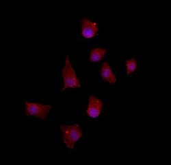 CtBP1 Polyclonal Antibody:Antibodies, Polyclonal