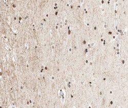 CtBP1 Polyclonal Antibody:Antibodies, Polyclonal