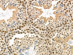 Invitrogen Phospho-CtBP1 (Ser422) Polyclonal Antibody 100 &mu;L | Buy Online | Invitrogen&trade; | Fisher Scientific