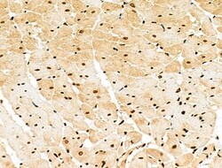 Invitrogen Phospho-CtBP1 (Ser422) Polyclonal Antibody 100 &mu;L | Buy Online | Invitrogen&trade; | Fisher Scientific