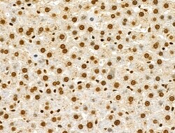 Invitrogen Phospho-CtBP1 (Ser422) Polyclonal Antibody 100 &mu;L | Buy Online | Invitrogen&trade; | Fisher Scientific