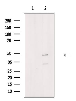 Invitrogen Phospho-CtBP1 (Ser422) Polyclonal Antibody 100 &mu;L | Buy Online | Invitrogen&trade; | Fisher Scientific