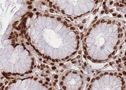 Invitrogen MEKK4 Polyclonal Antibody 100 &mu;L; Unconjugated:Antibodies,