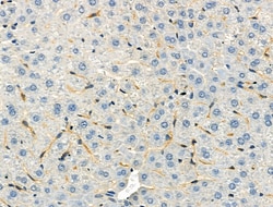 Invitrogen Phospho-Protein APC (Ser2054) Polyclonal Antibody 100 &mu;L;