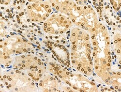 Invitrogen Phospho-NBS1 (Ser278) Polyclonal Antibody 100 &mu;L | Buy Online | Invitrogen&trade; | Fisher Scientific