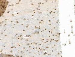Invitrogen Phospho-NBS1 (Ser278) Polyclonal Antibody 100 &mu;L | Buy Online | Invitrogen&trade; | Fisher Scientific