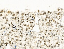 Invitrogen Phospho-NBS1 (Ser278) Polyclonal Antibody 100 &mu;L | Buy Online | Invitrogen&trade; | Fisher Scientific