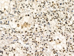 Invitrogen Phospho-NBS1 (Ser278) Polyclonal Antibody 100 &mu;L | Buy Online | Invitrogen&trade; | Fisher Scientific