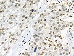 Invitrogen Phospho-NBS1 (Ser278) Polyclonal Antibody 100 &mu;L | Buy Online | Invitrogen&trade; | Fisher Scientific