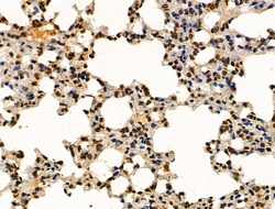 Invitrogen Phospho-NBS1 (Ser278) Polyclonal Antibody 100 &mu;L | Buy Online | Invitrogen&trade; | Fisher Scientific