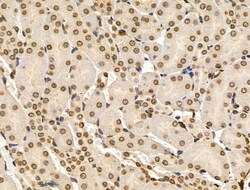 Invitrogen Phospho-NBS1 (Ser278) Polyclonal Antibody 100 &mu;L | Buy Online | Invitrogen&trade; | Fisher Scientific