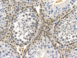 Invitrogen Phospho-NBS1 (Ser278) Polyclonal Antibody 100 &mu;L | Buy Online | Invitrogen&trade; | Fisher Scientific