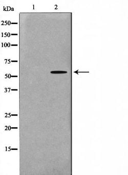 Invitrogen MAPKAPK5 Polyclonal Antibody 100 &mu;L; Unconjugated:Antibodies,