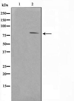 Invitrogen FER Polyclonal Antibody 100 &mu;L; Unconjugated:Antibodies,