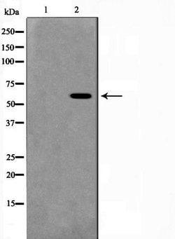 Invitrogen Phospho-AKT1/AKT2/AKT3 (Ser473) Polyclonal Antibody 100 &mu;L;