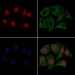 Invitrogen Phospho-Glucocorticoid Receptor (Ser211) Polyclonal Antibody