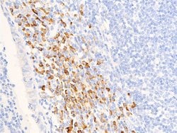 Invitrogen Phospho-Glucocorticoid Receptor (Ser211) Polyclonal Antibody