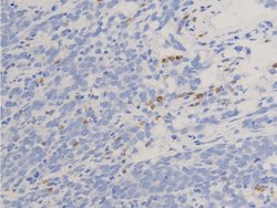 Invitrogen Phospho-Glucocorticoid Receptor (Ser211) Polyclonal Antibody