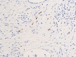Invitrogen Phospho-Glucocorticoid Receptor (Ser211) Polyclonal Antibody