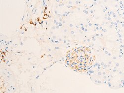 Invitrogen Phospho-Glucocorticoid Receptor (Ser211) Polyclonal Antibody