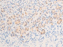 Invitrogen Phospho-Glucocorticoid Receptor (Ser211) Polyclonal Antibody