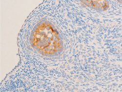 Invitrogen Phospho-Glucocorticoid Receptor (Ser211) Polyclonal Antibody
