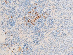 Invitrogen Phospho-Glucocorticoid Receptor (Ser211) Polyclonal Antibody
