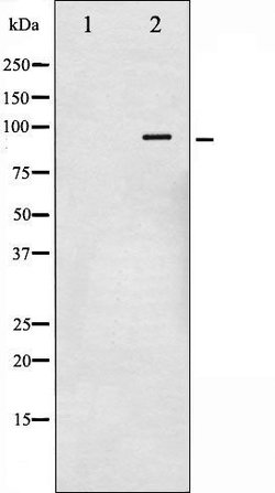 Invitrogen Phospho-Glucocorticoid Receptor (Ser211) Polyclonal Antibody