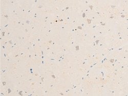 Invitrogen Phospho-SYK (Tyr323) Polyclonal Antibody 100 &mu;L | Buy Online | Invitrogen&trade; | Fisher Scientific