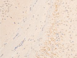 Invitrogen Phospho-SYK (Tyr323) Polyclonal Antibody 100 &mu;L | Buy Online | Invitrogen&trade; | Fisher Scientific
