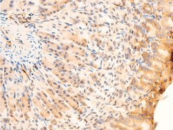 Invitrogen Phospho-SYK (Tyr323) Polyclonal Antibody 100 &mu;L | Buy Online | Invitrogen&trade; | Fisher Scientific