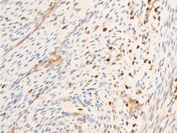 Invitrogen Phospho-SYK (Tyr323) Polyclonal Antibody 100 &mu;L | Buy Online | Invitrogen&trade; | Fisher Scientific