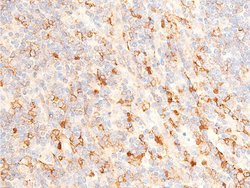 Invitrogen Phospho-Chk1 (Ser317) Polyclonal Antibody 100 &mu;L | Buy Online | Invitrogen&trade; | Fisher Scientific