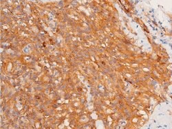 Invitrogen Phospho-Chk1 (Ser317) Polyclonal Antibody 100 &mu;L | Buy Online | Invitrogen&trade; | Fisher Scientific