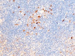 Invitrogen Phospho-Chk1 (Ser317) Polyclonal Antibody 100 &mu;L | Buy Online | Invitrogen&trade; | Fisher Scientific