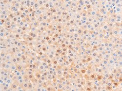 Invitrogen Phospho-Chk1 (Ser317) Polyclonal Antibody 100 &mu;L | Buy Online | Invitrogen&trade; | Fisher Scientific