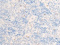 Invitrogen Phospho-Chk1 (Ser317) Polyclonal Antibody 100 &mu;L | Buy Online | Invitrogen&trade; | Fisher Scientific